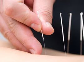 acupuncture weight loss clinics perth Baolin