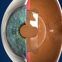 ophthalmological clinics in perth WA Laser Eye Centre - Melville