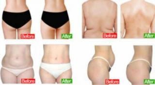 lose weight perth Quest Slimming & Beauty